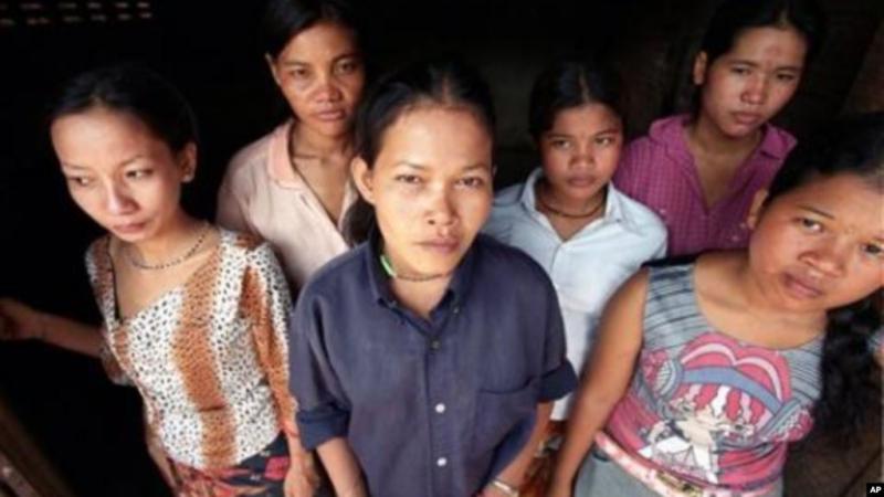 Korban Perdagangan Anak (AP/Voa Indonesia)