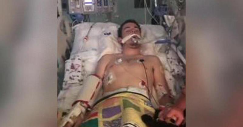 Tryson Zohfeld saat dirawat akibat paru-parunya tidak berfungsi (CBS News)
