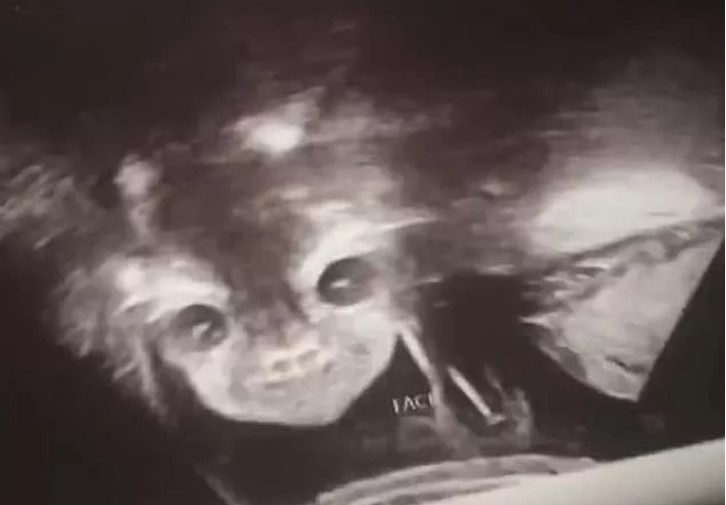 Hasil USG bayinya membuat Iyanna Carrington terkejut. (Foto: Kennedy News and Media)