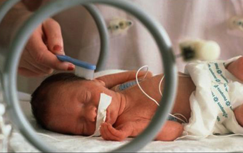 Bayi di dalam inkubator (Foto: Tribun)