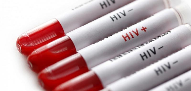 Ilustrasi Test Darah HIV (Foto:Pakistantoday.com)