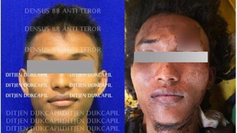 Rabbial Muslim Nasution, Terduga pelaku bom bunuh diri di Polrestabes Medan, Sumatera Utara. (Tribunnews)