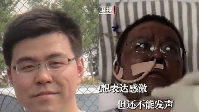 dokter positif corona di China kulitnya menghitam (Tribunnews)