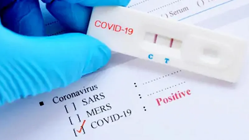 Ilustrasi rapid test covid-19 (Foto:shutterstock.com/g/jarun011)