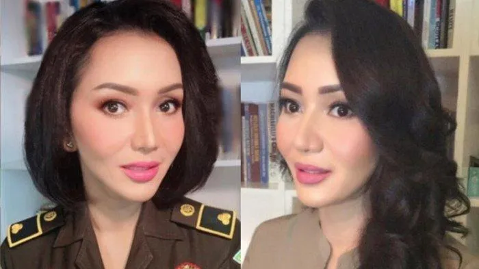 Jaksa Pinangki yang diduga terima uang dari Djoko Tjandra melakukan operasi plastik di AS (tribunnews)