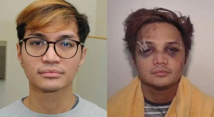 Foto Predator seksual Reynhard Sinaga bonyok usai dipukuli korbannya (Net)