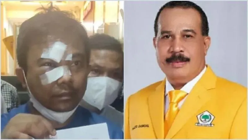Ketum KNPI Duga Pengeroyokan Dirinya Terkait Masalah Internal Golkar. (Kolase dari berbagai sumber).