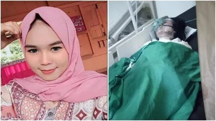 Lantaran Cemburu, Anggota Polisi di Muara Enim Bakar Pacarnya Sendiri. (Kolase dari Berbagai Sumber).