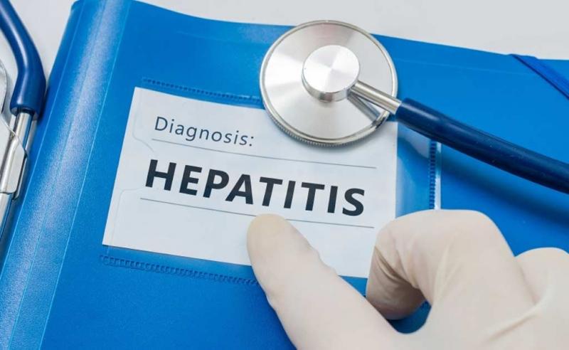 Ilustrasi hepatitis misterius (jawapos)