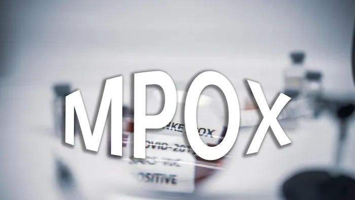 Ilustrasi penyakit Mpox (Ist)