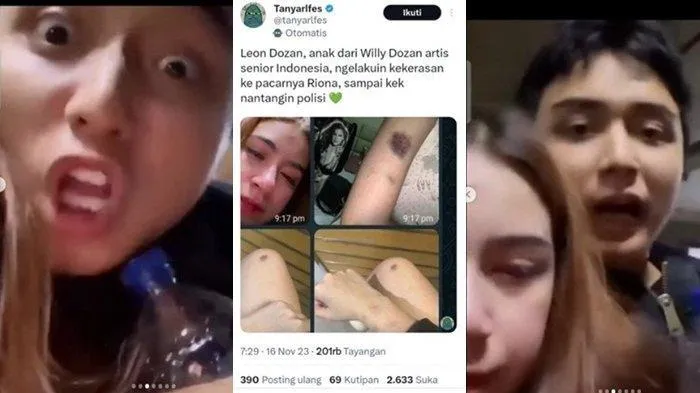 Kasus Dugaan Aniaya Rinoa Aurora, Polisi Ringkus Anak Willy Dozan. (Kolase dari berbagai sumber).