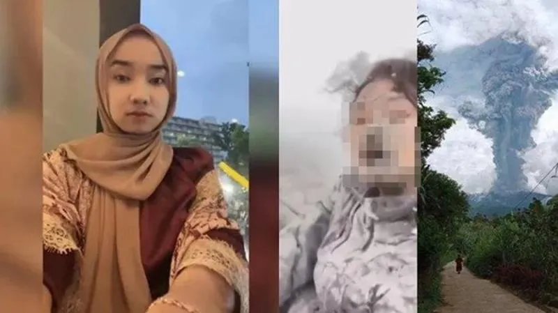Sempat 13 Hari Dirawat, Ife Korban Erupsi Marapi Meninggal Dunia. (Kolase dari berbagai sumber).