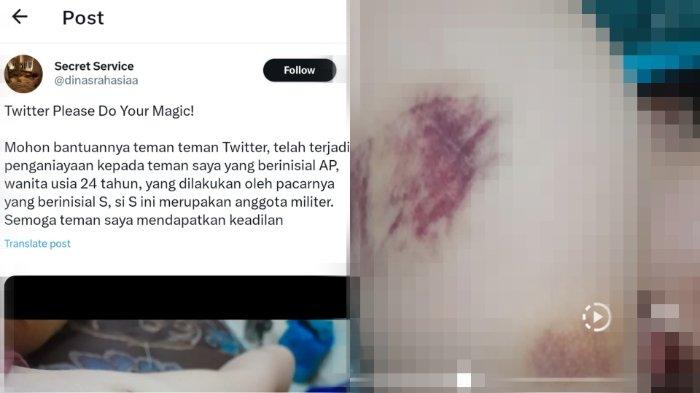 Viral Mahasiswi asal Padang Diduga Dianiaya Pacarnya yang Anggota TNI. (Medsos).
