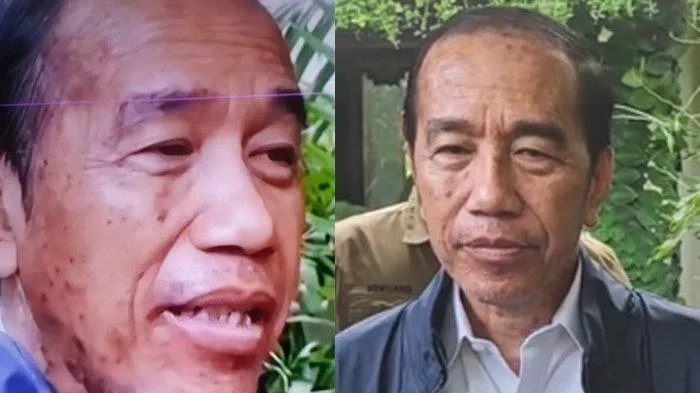 Terkena Alergi Kulit, Jokowi Kini Jalani Proses Penyembuhan. (Istimewa).