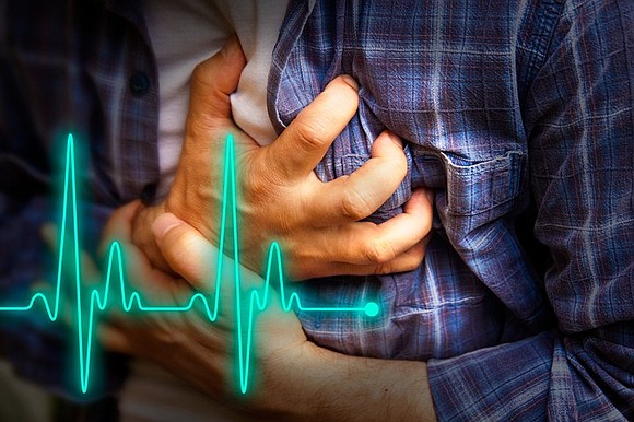 Ilustrasi penyakit jantung koroner. (Foto: Stylemagazine)