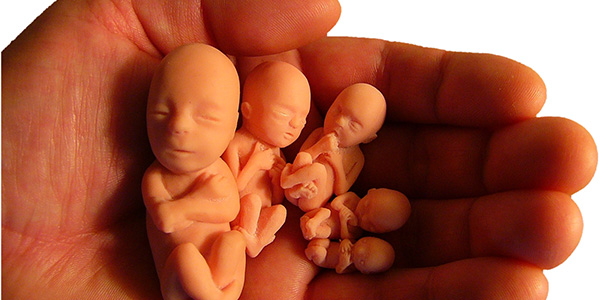 Ilustrasi aborsi (Foto: Str.org)